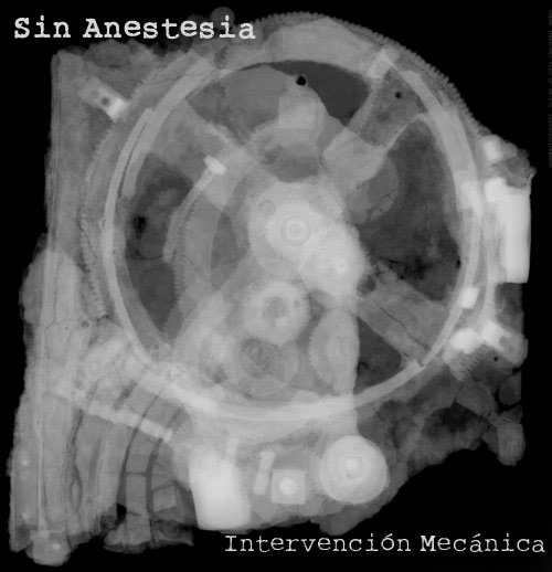 Sin Anestesia - Intervención Mecánica